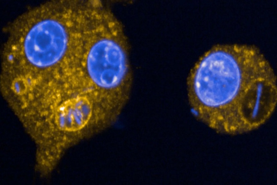 تحذير من منظمة الصحة العالمية.. 