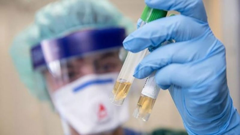 إيطاليا تبتكر أول لقاح يوقف انتشار كورونا في الخلايا البشرية 