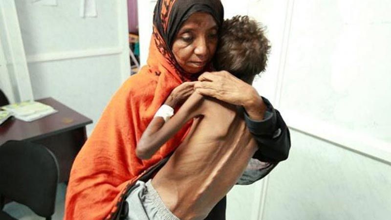 "اليونيسف": أطفال اليمن على شفا المجاعة