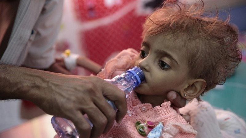 "سي إن إن" تعترف: الحصار السعودي أدى إلى تفاقم المجاعة في اليمن