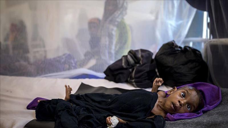 نتيجة العدوان والحصار.. اليمن رهن الأمراض والأوبئة